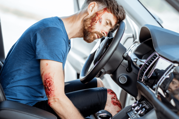 Injured man with visible wounds sitting in car after accident showing pain and suffering damages for car accident claims calculation