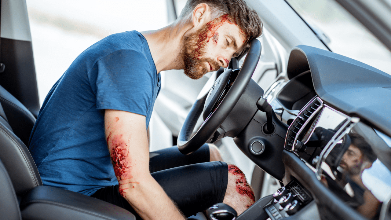 Injured man with visible wounds sitting in car after accident showing pain and suffering damages for car accident claims calculation